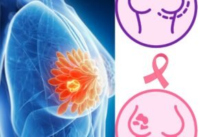 lump in breast symptoms